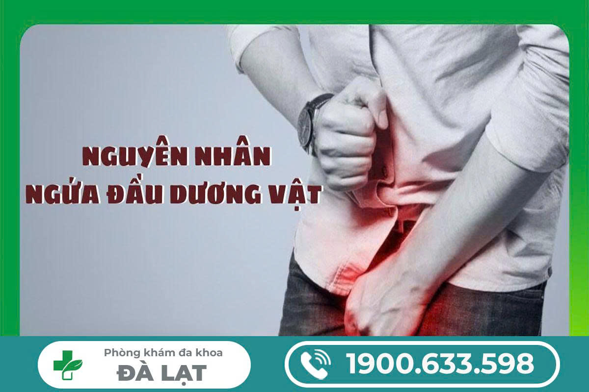 Hình ảnh minh họa